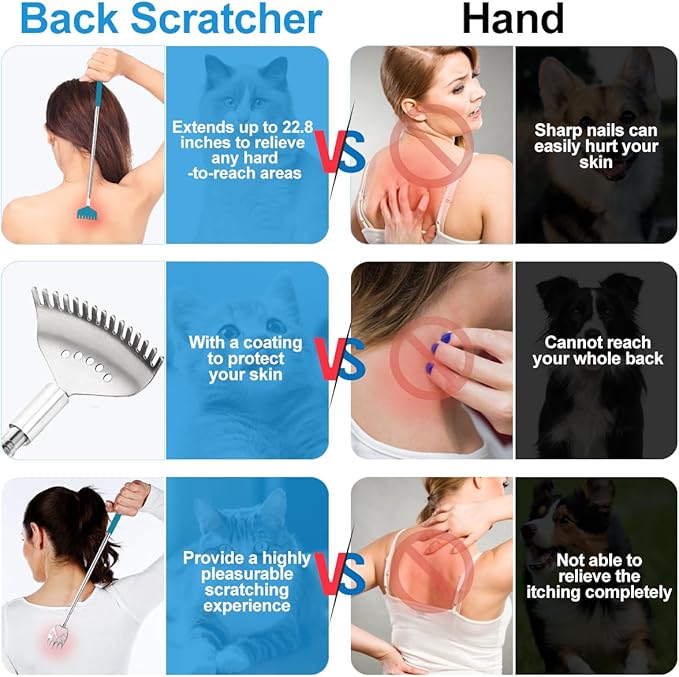 3 Pack Different Back Scratcher Metal Portable Telescoping Back scratchers, Extendable Back Massager Tool with Beautiful Box, Great Stocking Stuffers for Men Women Kids Adults（Blue）